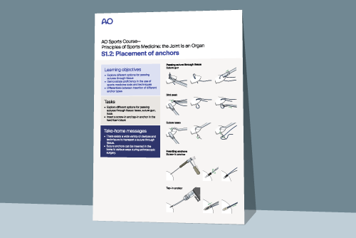 shoulder poster of anchor placement presented on abstract blue background