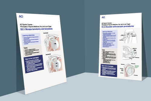 shoulder poster of biceps tenotomy and tenodesis and arthroscopic procedures presented on abstract blue background