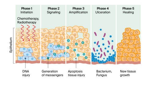 illustration of 5 stages of mucositis