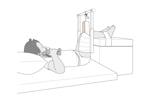 boy lying in bed with 90/90 femur skin traction