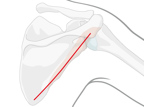 approach image with incision line to posterior scapula