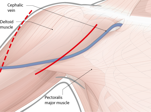 anterior view of right shoulder with anatomical structures